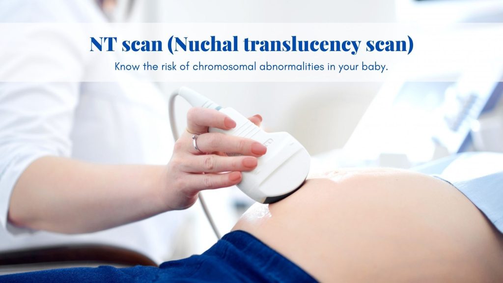 Nuchal Translucency Scan