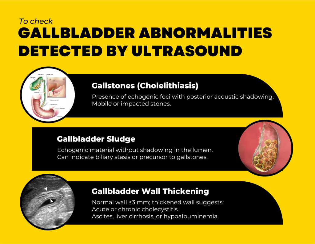 GALLBLADDER ABNOMALITIES 1