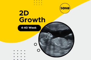 Growth Scan