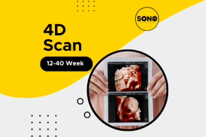 4D Scan