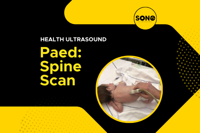 Sonobee Health Paed Spine Scan