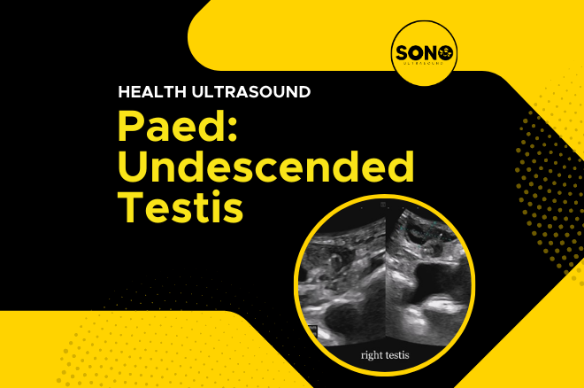 Sonobee Health Paed undescended testis