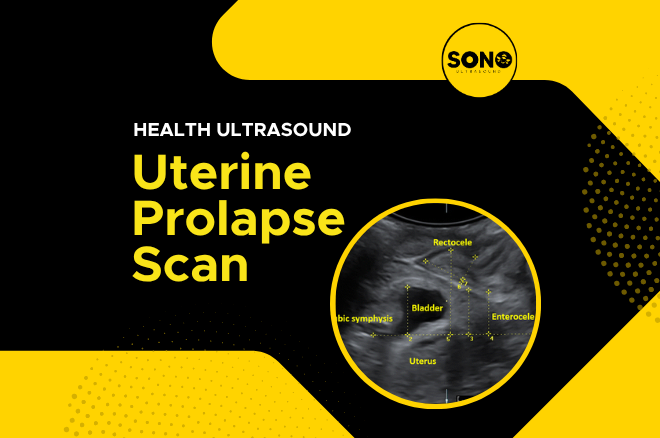 Uterine Prolapse Scan