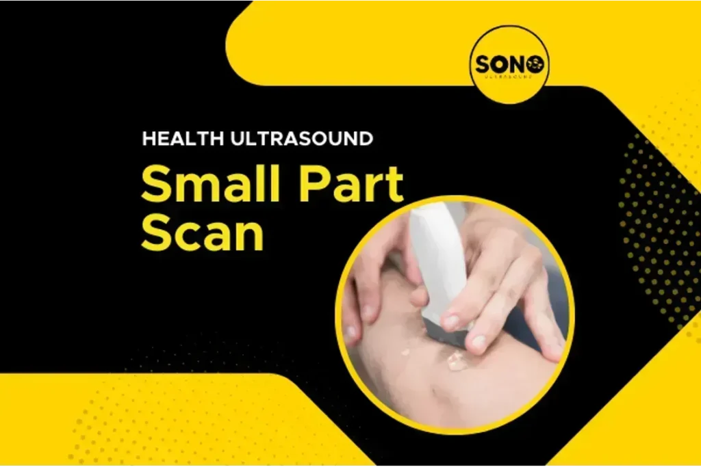 Health Screening Small Part Scan