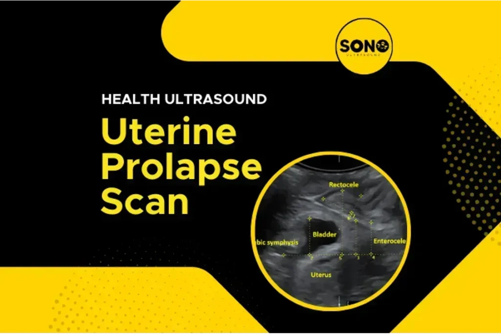 Health Screening Uterine Prolapse Scan