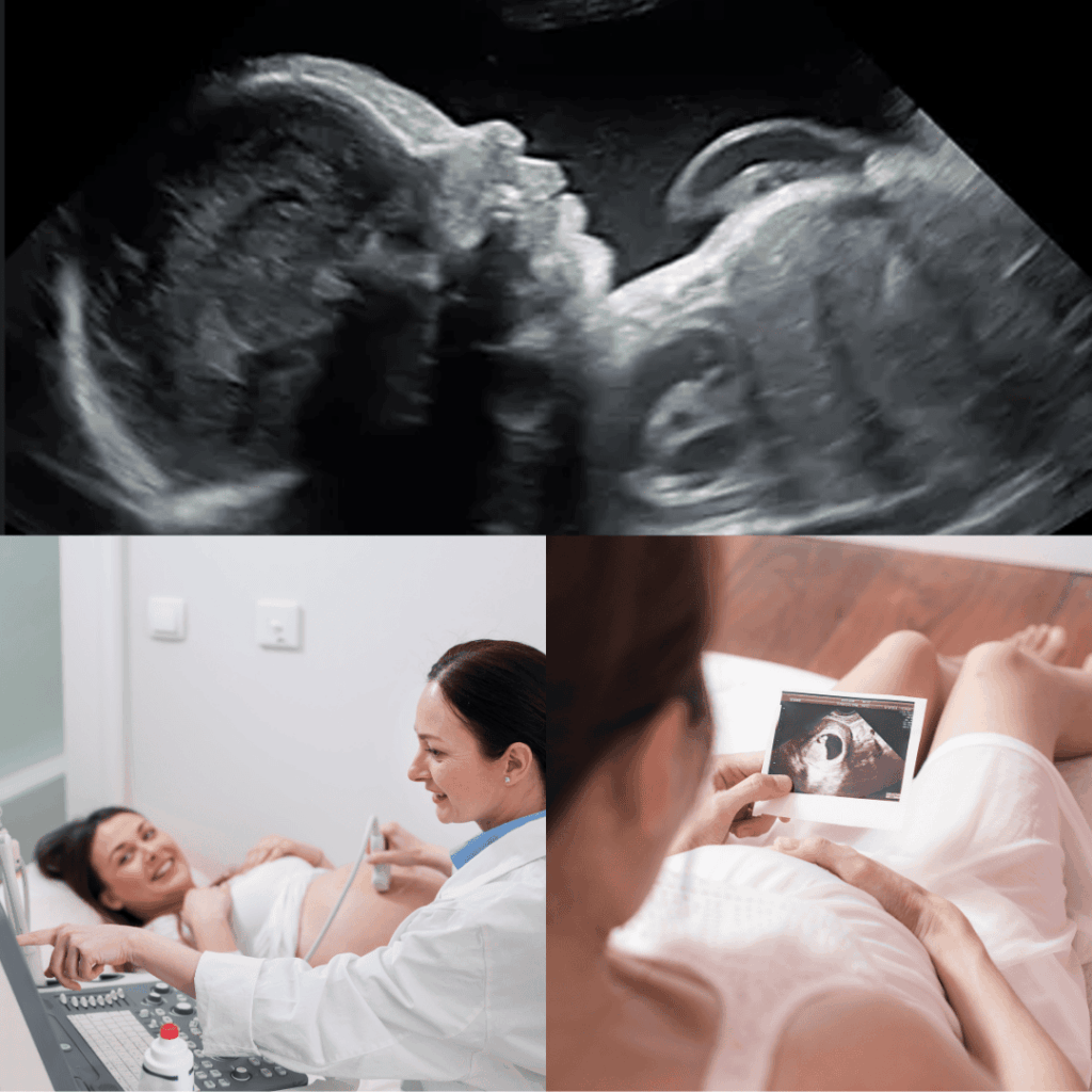 maternity-scan-malaysia