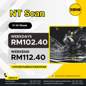 NT Scan Johor Sabah Sarawak