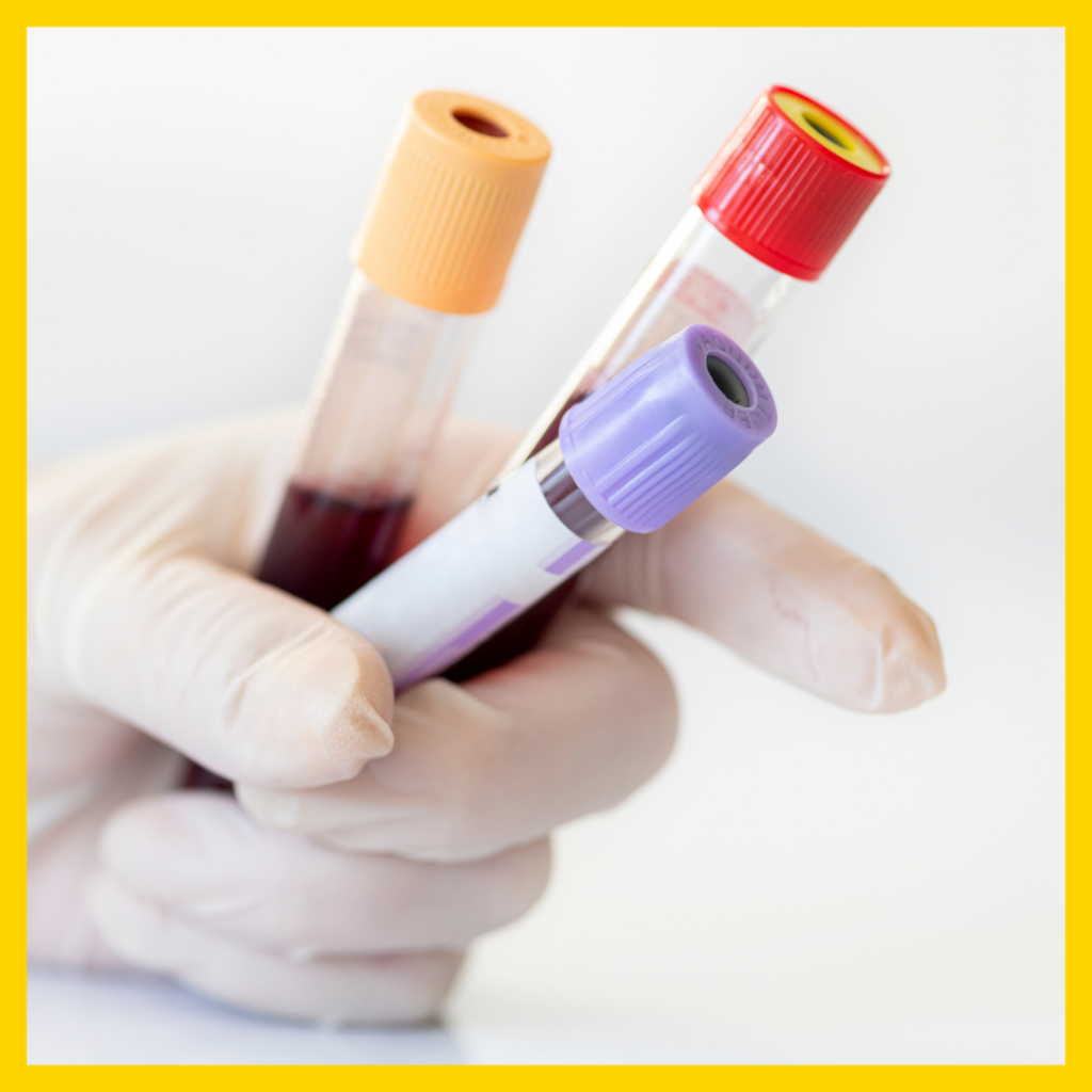 Blood Test Image 1