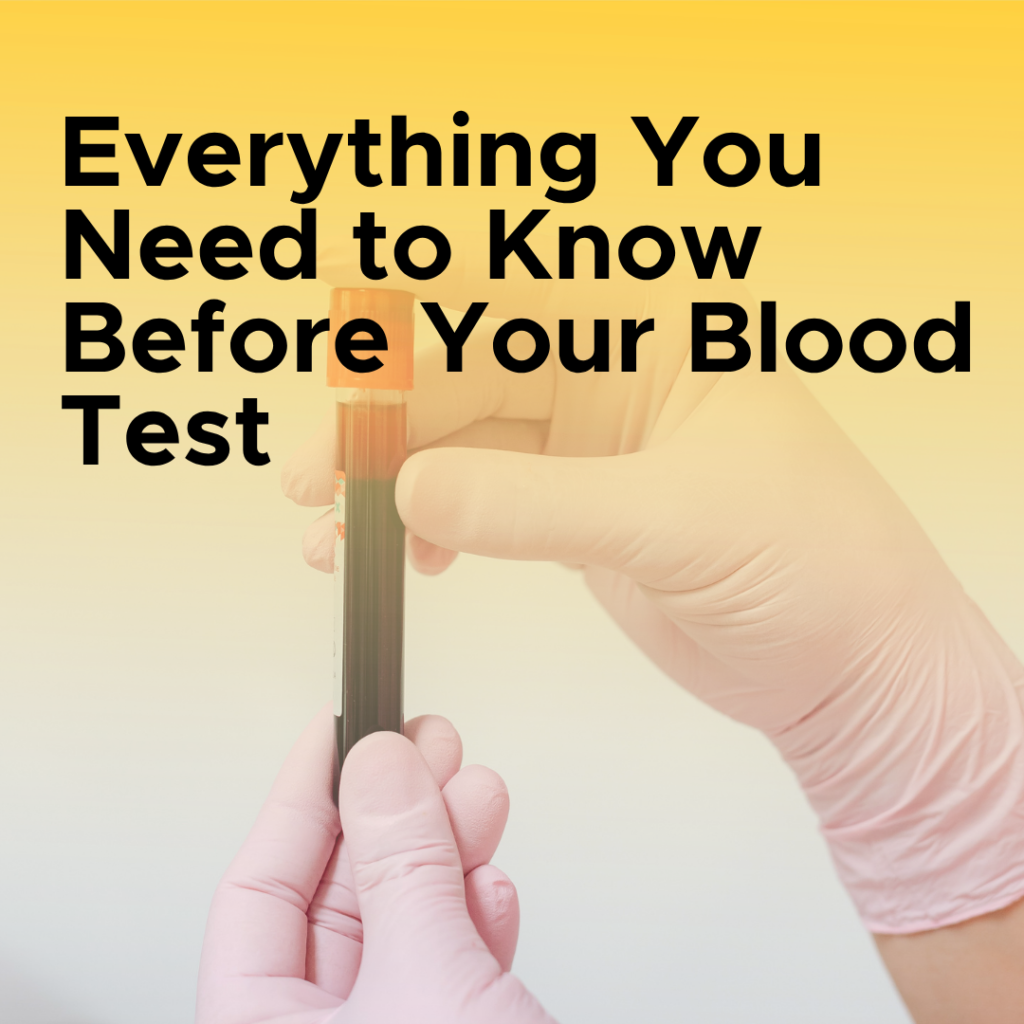 Everything You Need to Know Before Your Blood Test