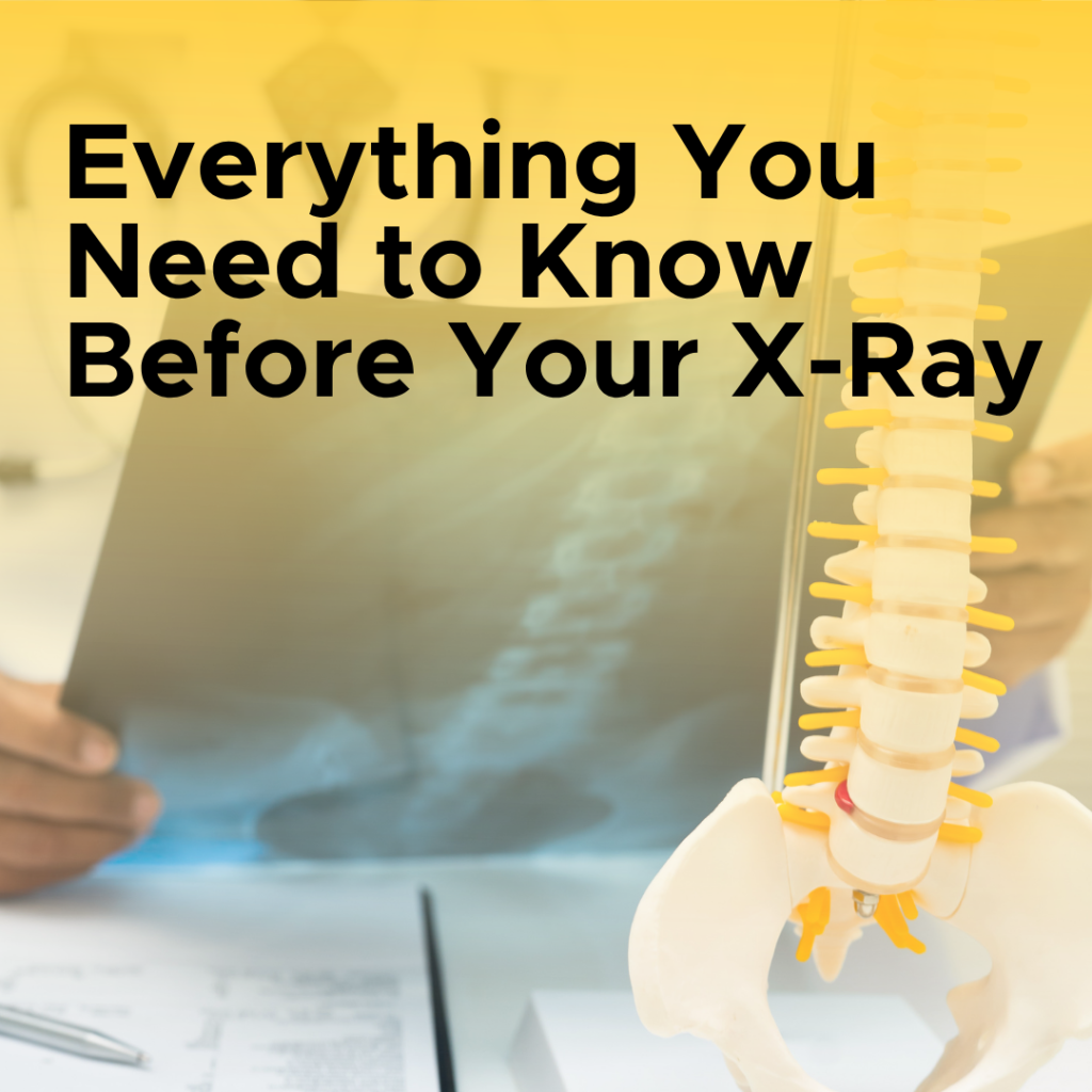 Everything You Need to Know Before Your X Ray