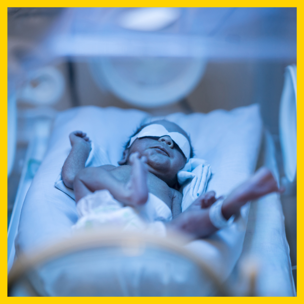 newborn jaundice