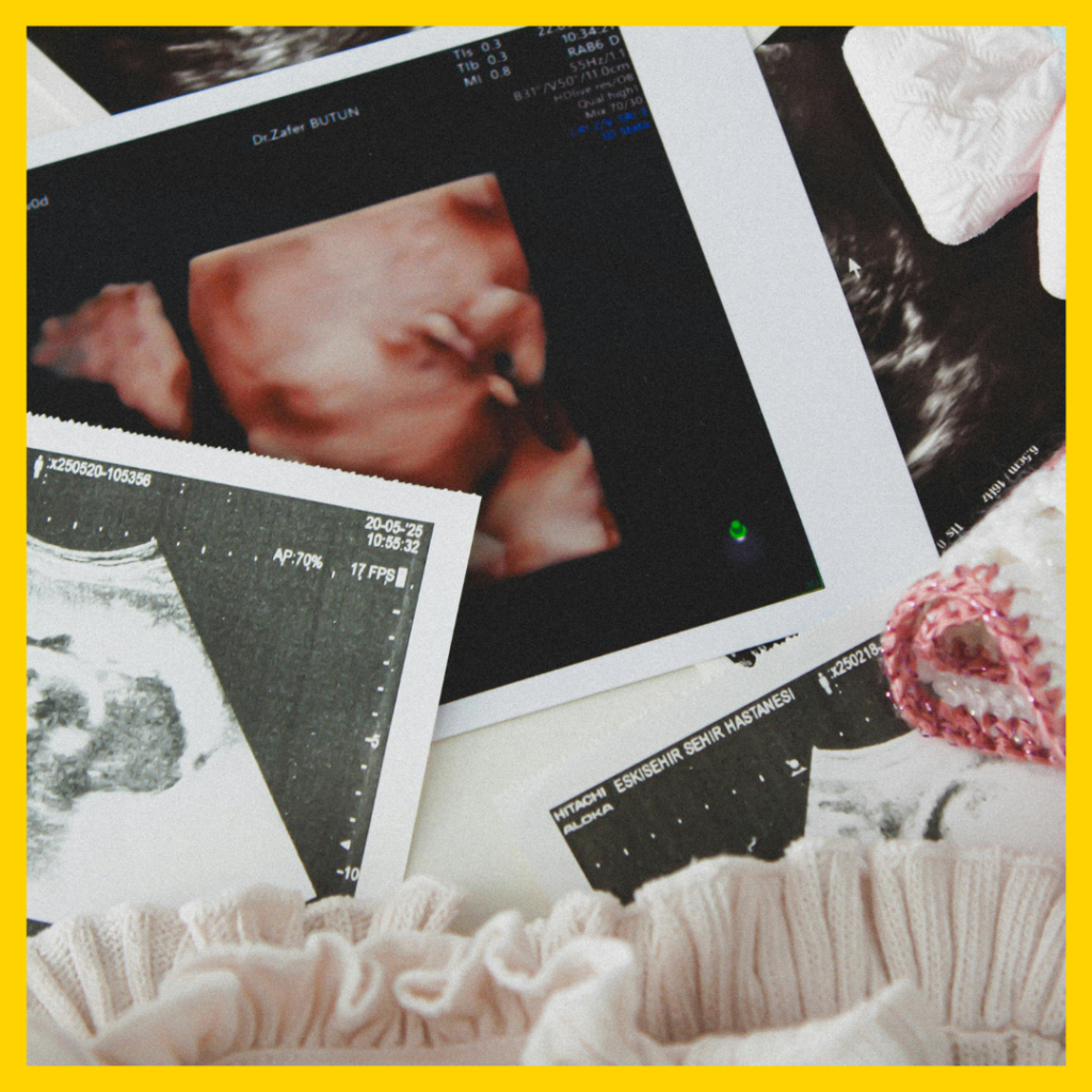 pregnancy scan images