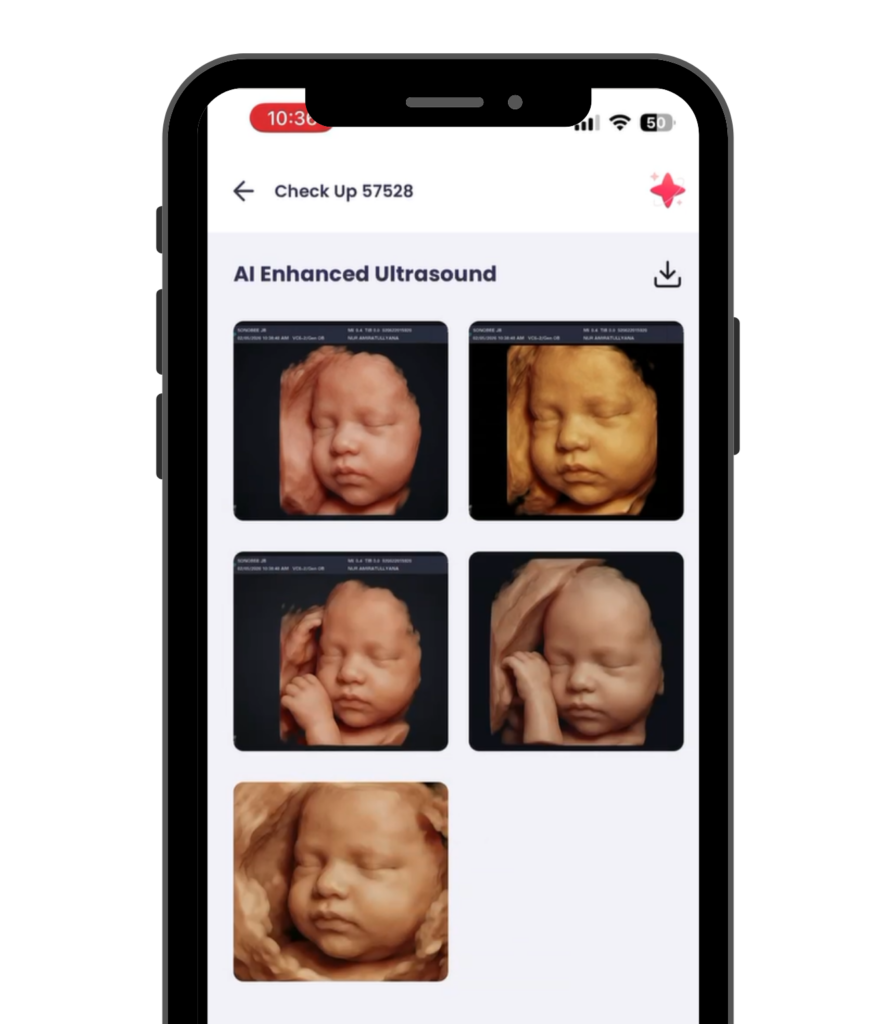8K Ultrasound FlabeeReal