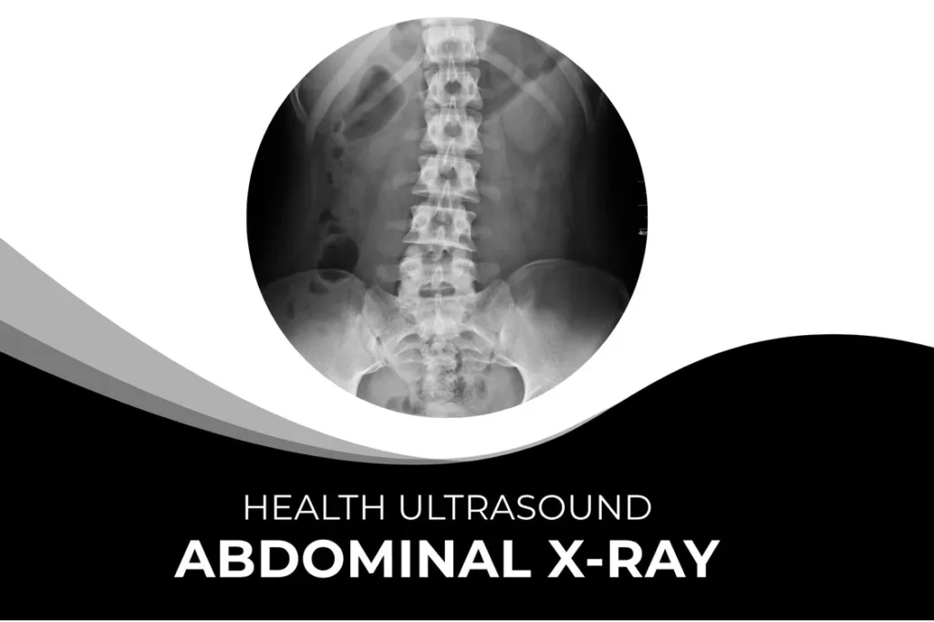 Abdominal X Ray