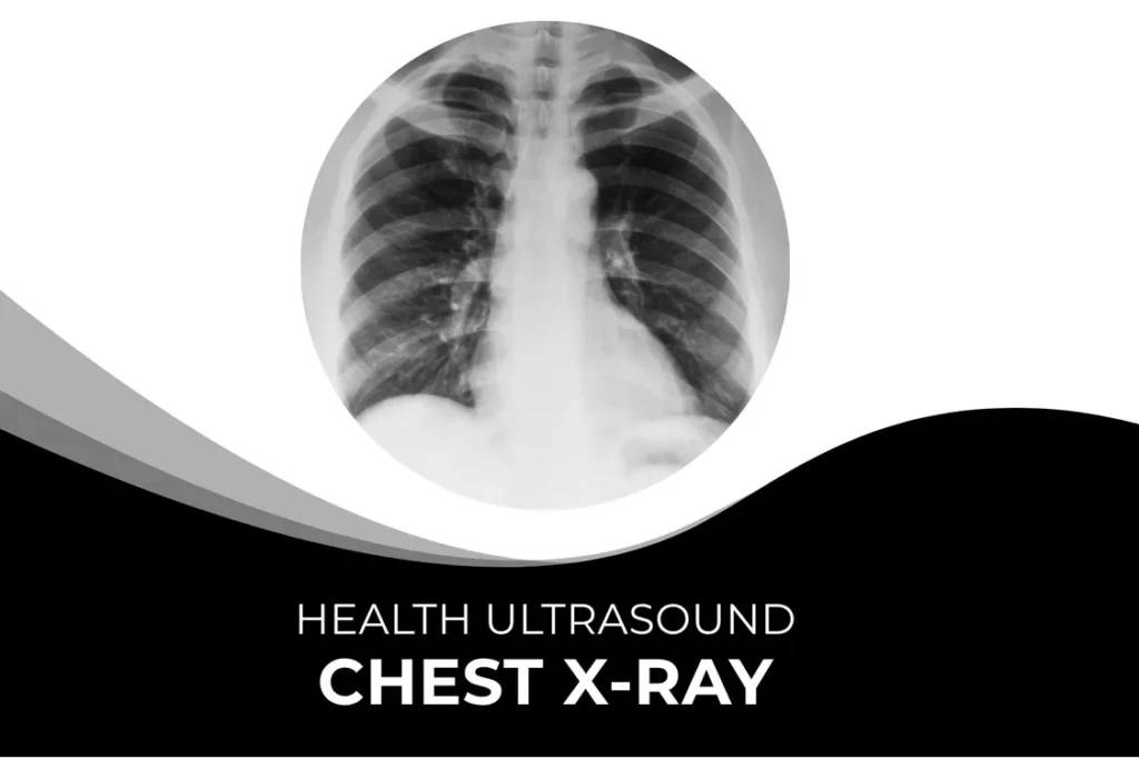 Chest X Ray