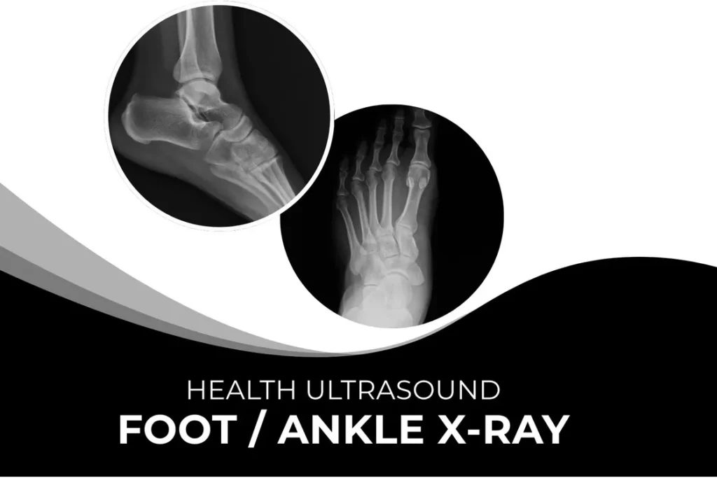 Foot | Ankle X-Ray