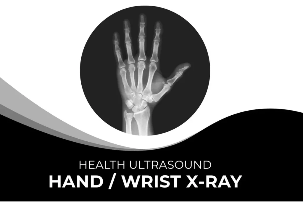 Hand | Wrist X-Ray