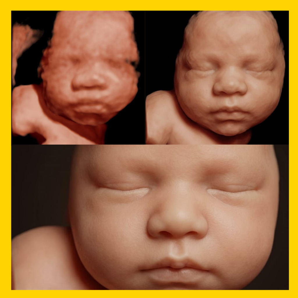 Sonobee Ultrasound 5D 8K scan