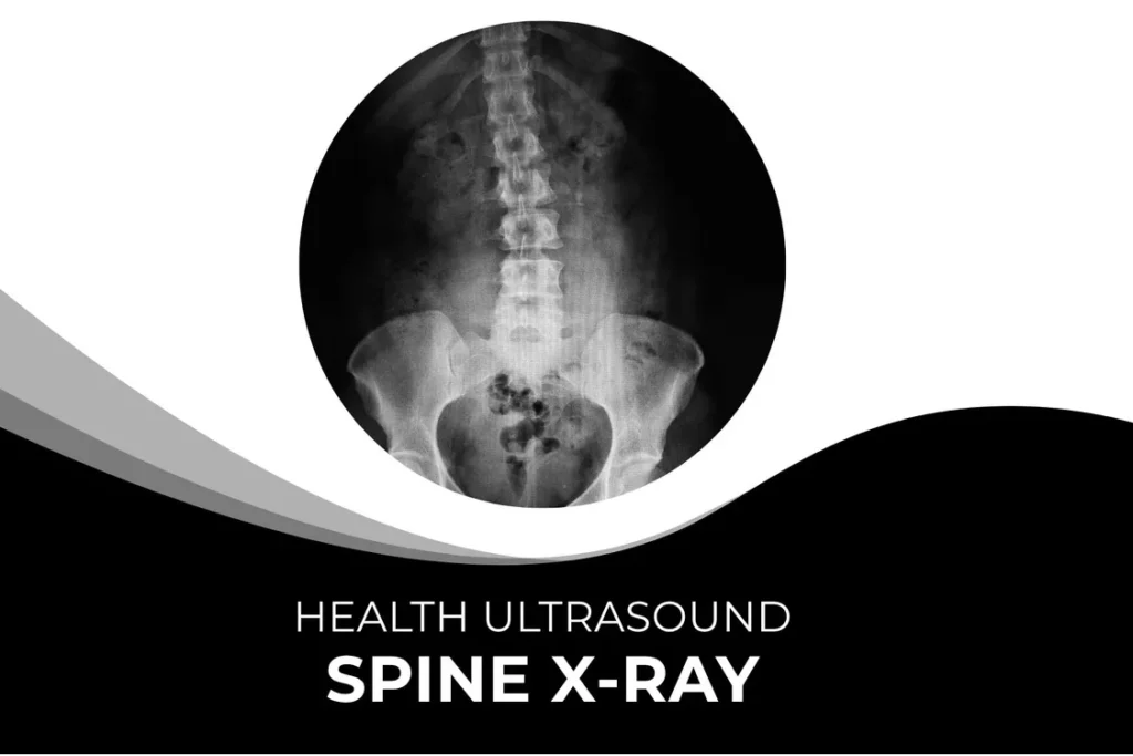 Spine X Ray
