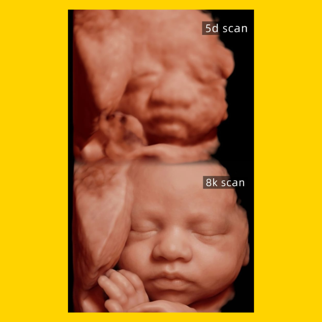 comparison 5D Scan 8K Scan