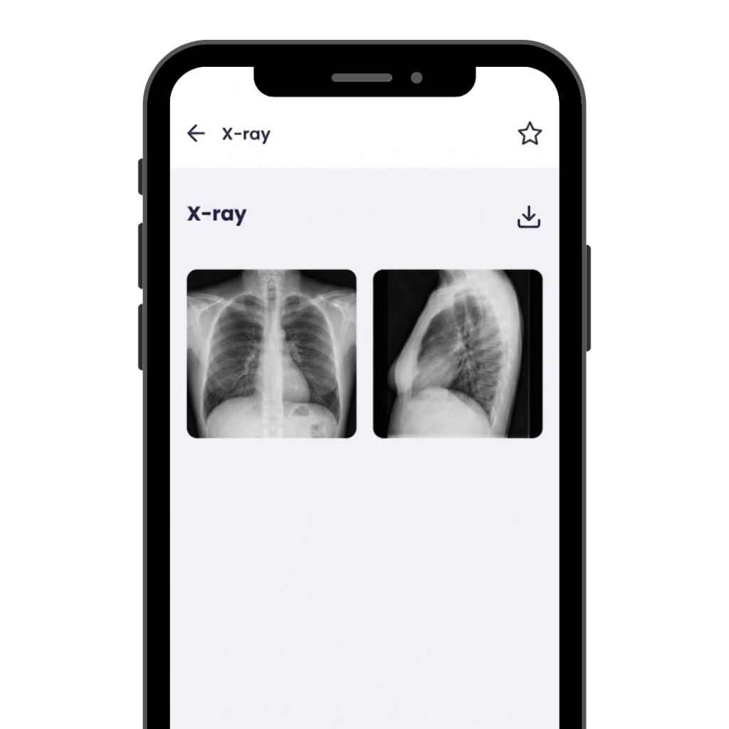 mockup x ray