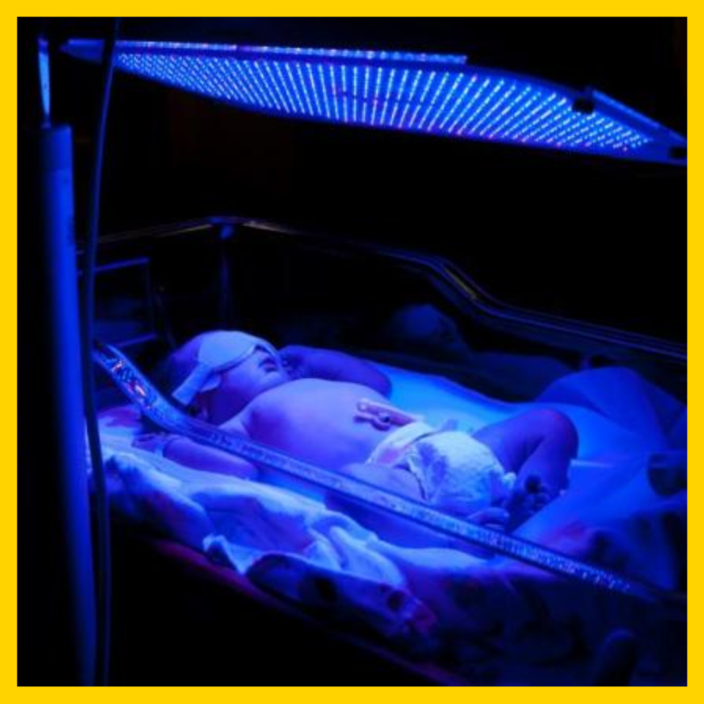 Is Home Phototherapy Safe