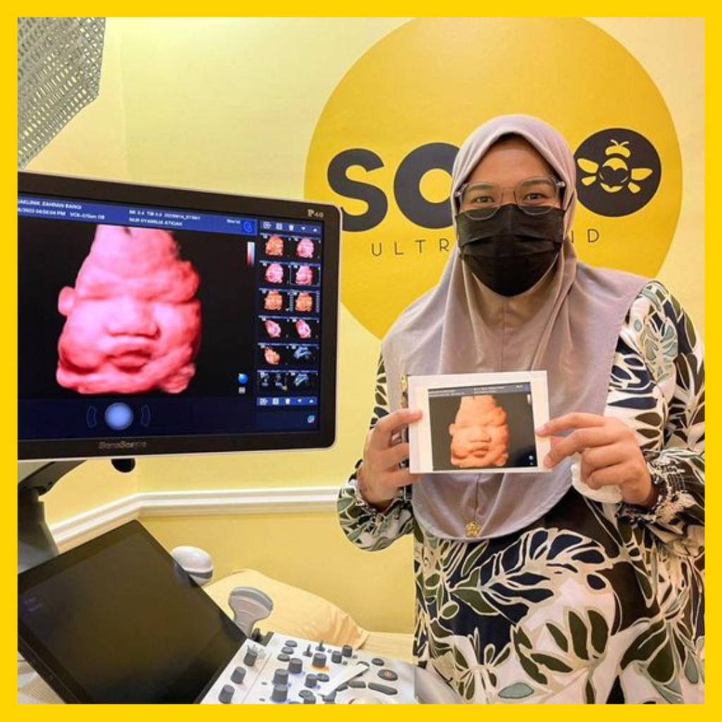 Why More Than 300000 Pregnant Mothers Trust Sonobee