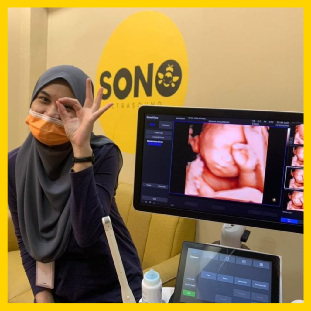 baby scan