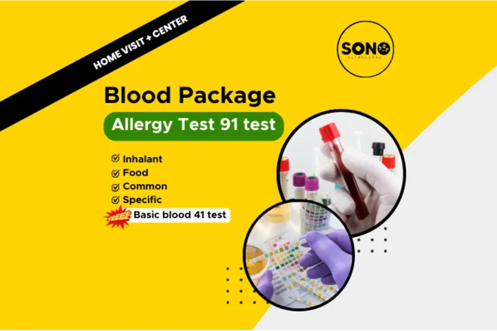 Sonobee-Screening-Allergy Test 91 test FREE basic blood & Urine Test